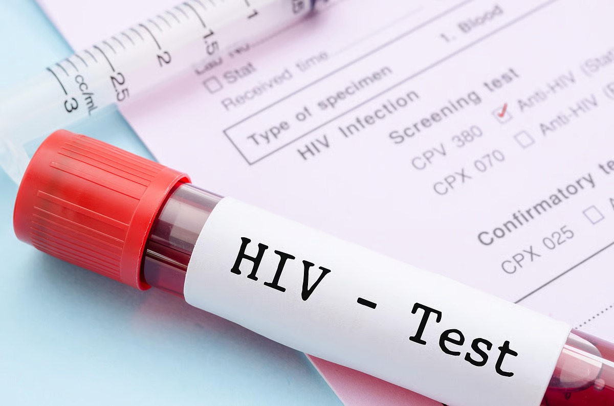 HIV Cases Rise Among Karnataka’s Youth : Government Orders Campus Testing Drive