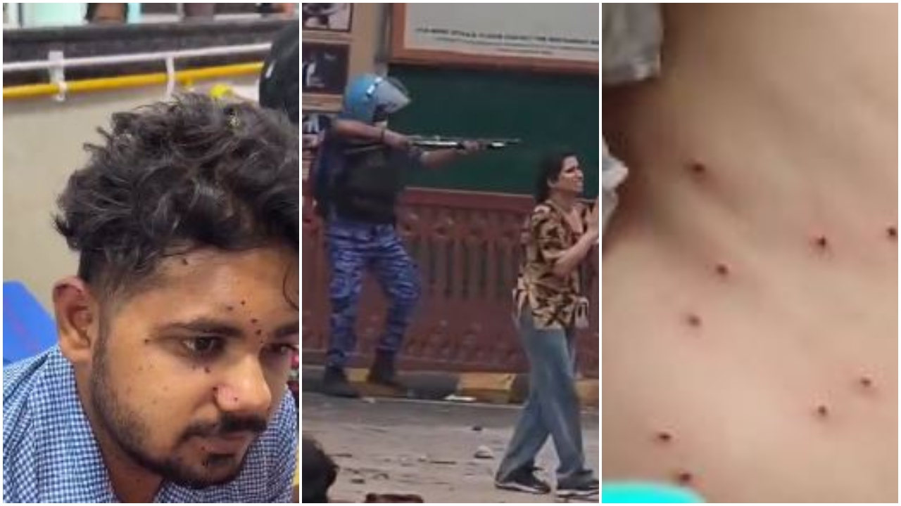 At least 10 people were injured by pellets on July 20, an RTI reply has revealed